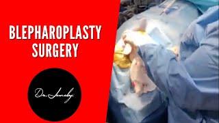 Blepharoplasty with Top Plastic surgeon DrJeneby Part 2