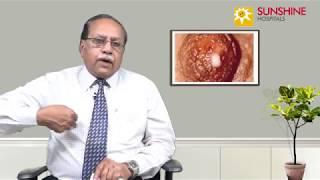 Watch Dr. C. S. Indra Mohan, Consultant General Surgeon, talk about Breast nipple discharge