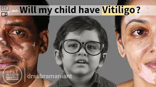 Every parent with vitiligo must know!