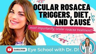 Ocular Rosacea Treatment, Triggers, Diet, and Causes | How do you get rid of ocular rosacea?