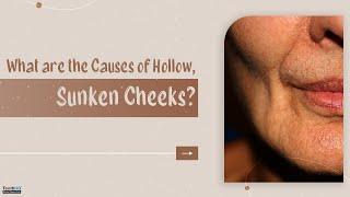 What are the Causes of Hollow, Sunken Cheeks? Tooth Loss is the Primary Reason