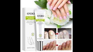 Efero Nail Treatment Repair Gel in Bangladesh || Efero Nail Treatment Review