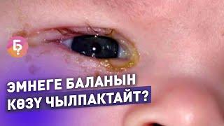 Эмнеге жаш баланын көзү чылпактап калат? Педиатр айтып берет