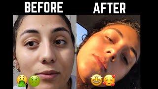 GIRLFRIEND DOES BOYFRIENDS SKINCARE ROUTINE!!1