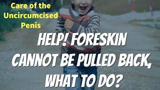 I CAN'T PULL THE FORESKIN BACK, WHAT ARE OTHER OPTIONS TO TREAT?