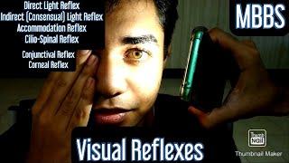 Visual Reflexes- Direct Light Reflex, Indirect (Consensual) Light Reflex, Accommodation Reflex #mbbs