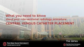 Central venous catheter placement | Ohio State Medical Center