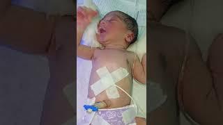 ️New born cute baby girl #trending #youtubeshorts #viral #baby #baby #shorts