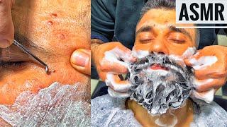 Asmr Beard Cut • Acne clearing and relaxation session  • MASSAGE