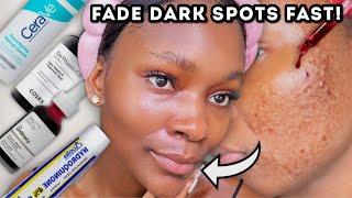 How to ACTUALLY fade dark spots and hyperpigmentation | products and ingredients you need