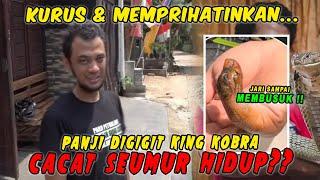 SOK JAGOAN! Panji Petualang Cacat Seumur Hidup Digigit King Kobra? | Kondisi Panji Miris & Kurus