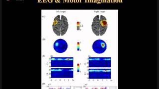 The Brain-computer Interface