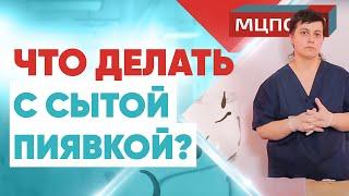 Что делать с сытой пиявкой? Курсы гирудотерапии. Обучение как ставить пиявки. Гирудотерапия