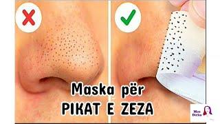 MASKA PER PIKAT E ZEZA | SI TE HEQIM PIKAT E ZEZA | SI TE PASTROJME PORET | MASKA NE KUSHTE SHTEPIE