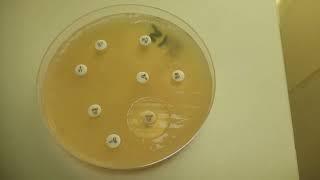 Antimicrobial Susceptibility Testing of Bacteria on Muller-Hinton agar Demonstration