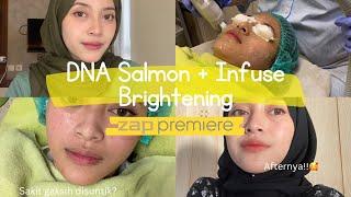 COBAIN TREATMENT DNA SALMON + INFUSE BRIGHTENING DI ZAP CLINIC! Gimana hasilnya?