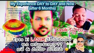 Lasik or Laser Surgery for Eyes in Telugu || My experience of Lasik surgery after 6 months #lasik