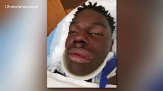 Teen recovering after fight during semi-pro football game in Vidor