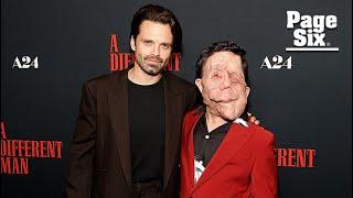 Sebastian Stan slams reporter for describing co-star Adam Pearson as a ‘beast’ over disfigurement