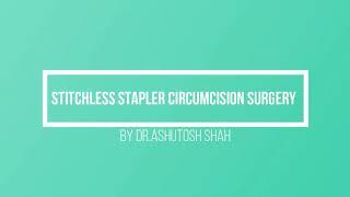 Stapler Stitchless Circumcision, Circumcision Surgery, Revision Circumcision, Surat,Ahmadabad,Mumbai