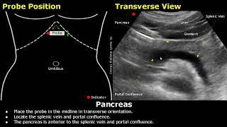 Pancreas Ultrasound Probe Positioning | Transducer Placement & Scanning | Abdominal USG | Sonography