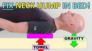 Best SYSTEM To Fix Neck Hump, Forward Head Posture & Hunchback IN BED!