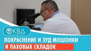  Покраснение и зуд мошонки и паховых складок. Клинический случай №642