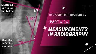 Radiography Procedures: Measurements in Radiography