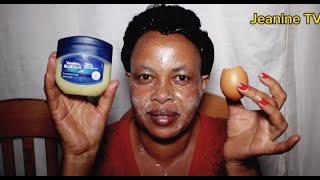 Vaseline original niwayivanga n'ibi bizoguhindurira amateka mu mwanya muto cane.