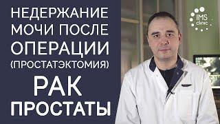 Недержание мочи после удаления предстательной железы. Рак простаты. Простатэктомия (последствия)