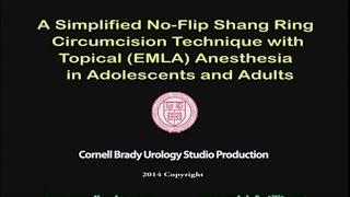 A Simplified No-Flip Shang Ring Circumcision Technique with Topical (EMLA) Anesthesia