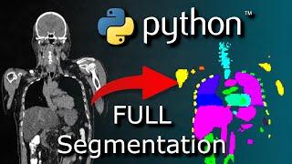 Python AI Organ Segmentation Tutorial