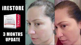 3 MONTH RESULTS from iRestore Low Level Laser Therapy LLLT | BEFORE & AFTER