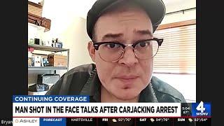Man shot in the face talks after carjacking arrest