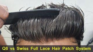 Q6 Hair Patch vs Swiss Full Lace Hair Patch System by Planet of Hair Cloning Call +91 9899746489