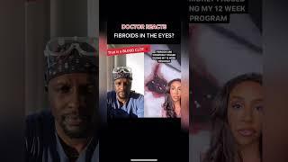 Diagnose FIBROIDS By Looking Into Your Eyes | Doctor Reacts