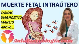 MUERTE FETAL INTRAÚTERO, CAUSAS, DIAGNÓSTICO, MANEJO, APOYO... - Ginecología y Obstetricia -