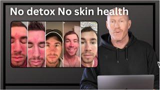 Step By Step Cleansing / Detox protocol to heal Eczema and Psoriasis FASTER