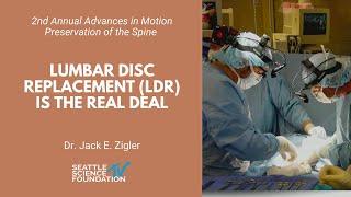 Lumbar Disc Replacement LDR Is the Real Deal - Jack E. Zigler, MD