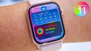 Apple Watch Series 10 | WatchOS 11 | Apple Watch X