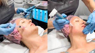 PRX-T33 BioLift Peel + SkinPen Microneedling: AdmireMD Skin Clinic - Scottsdale, AZ