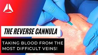 How to take blood with an intravenous cannula - a novel technique for the smallest veins!