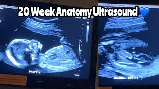 20 Week Ultrasound | Anatomy Scan | #20weekultrasound