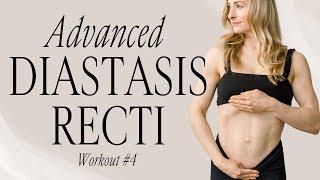 Advanced Diastasis Recti Repair Plan - Workout #4 - Lauren Fitter