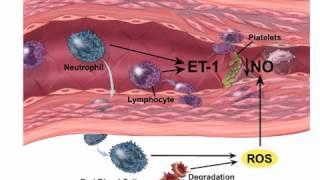 Emergency Management of SAH