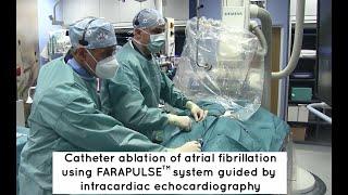 Catheter ablation of atrial fibrillation