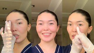 Reduce Puffiness and Wrinkles in 10 Minutes. Buccal Self-Massage by Aigerim Zhumadilova