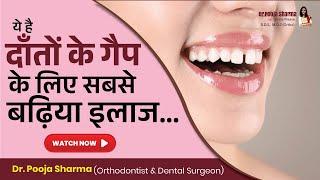 Teeth Space/Dental Gap के Latest & Best Treatment Options | Teeth Gap Treatment In Agra - Dr Pooja