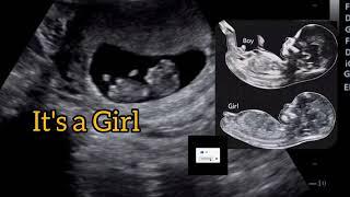 it's a baby girl by 'Nub Theory' !! Ultrasound