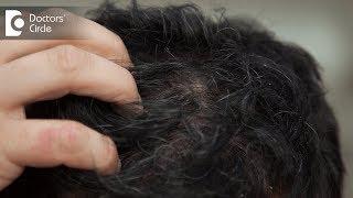 What are the causes of a sensitive and painful scalp? - Dr. Amee Daxini